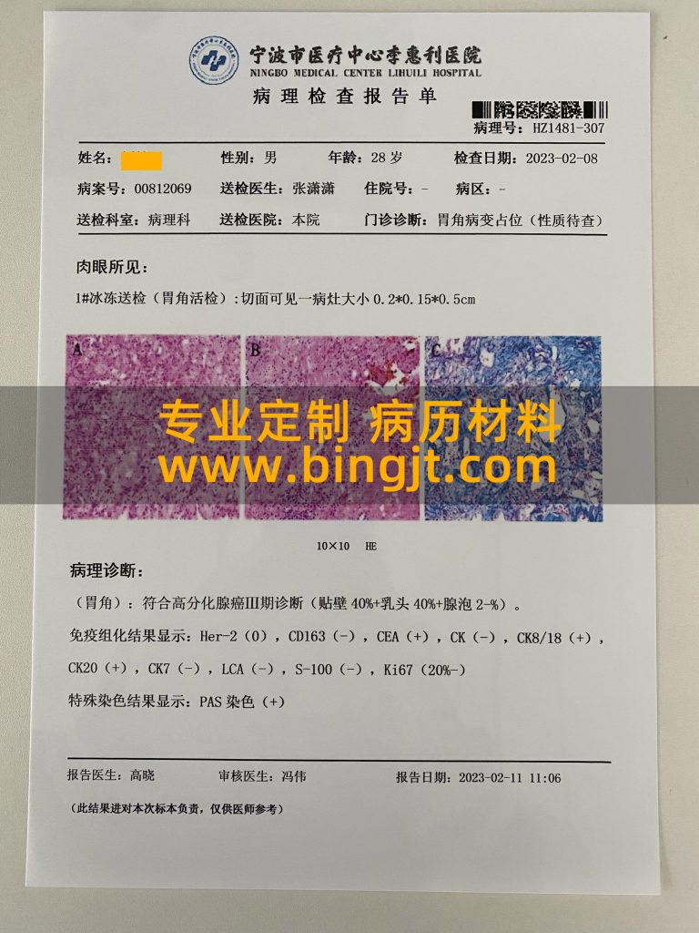 癌症病理检查报告单