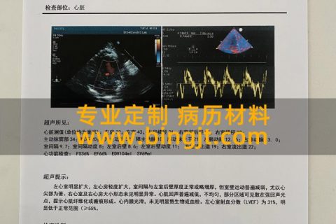 心脏彩超检查报告单